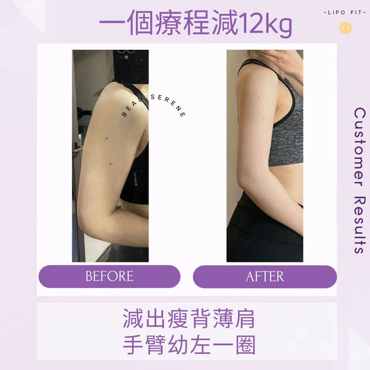 顧客效果：一個療程減12KG！減出瘦背薄肩